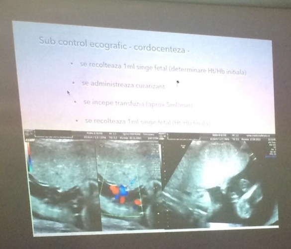 transfuzii intrauterine