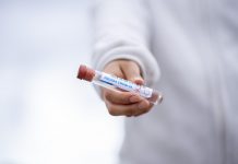 Coronavirus, 8 februarie: aproape 1.700 de cazuri în Timiș și 193 de decese la nivel național