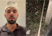 Bataie in fata unui club de noapte din Timisoara! Un tanar de 19 ani a fost transportat la spital